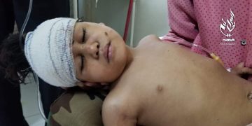 مركز المعلومات يدين قصف الحوثيين أحياء بتعز اليوم ويطالب المجتمع الدولي بتحمل المسؤولية تجاه جرائم الحرب الممنهجة