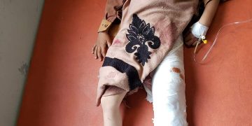 مركز المعلومات يدين قصف مليشيا الحوثي الأحياء السكنية المكتضة بالمدنيين في تعز