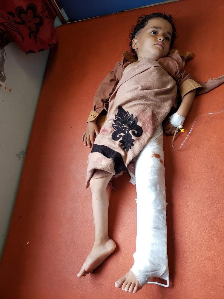 The Information Center condemns the bombing by the Houthi militia of residential neighborhoods crowded with civilians in Taiz