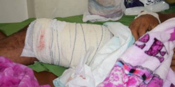 استمرار القنص على تعز