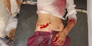 58 انتهاكا يوثقها مركز المعلومات خلال يونيو الماضي بتعز