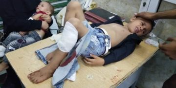 87 انتهاكا يوثقها مركز المعلومات خلال يوليو الماضي بتعز